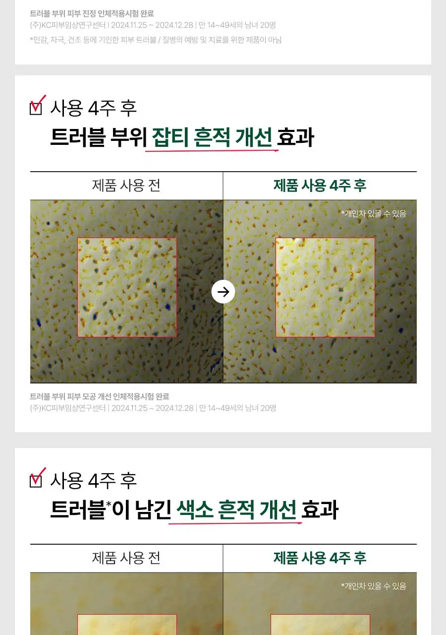 [7월올영픽/1+1/수분진정] 닥터지 레드블레미쉬 클리어 히알시카수딩세럼 50ml기획 (+50ml리필) 상세페이지 36